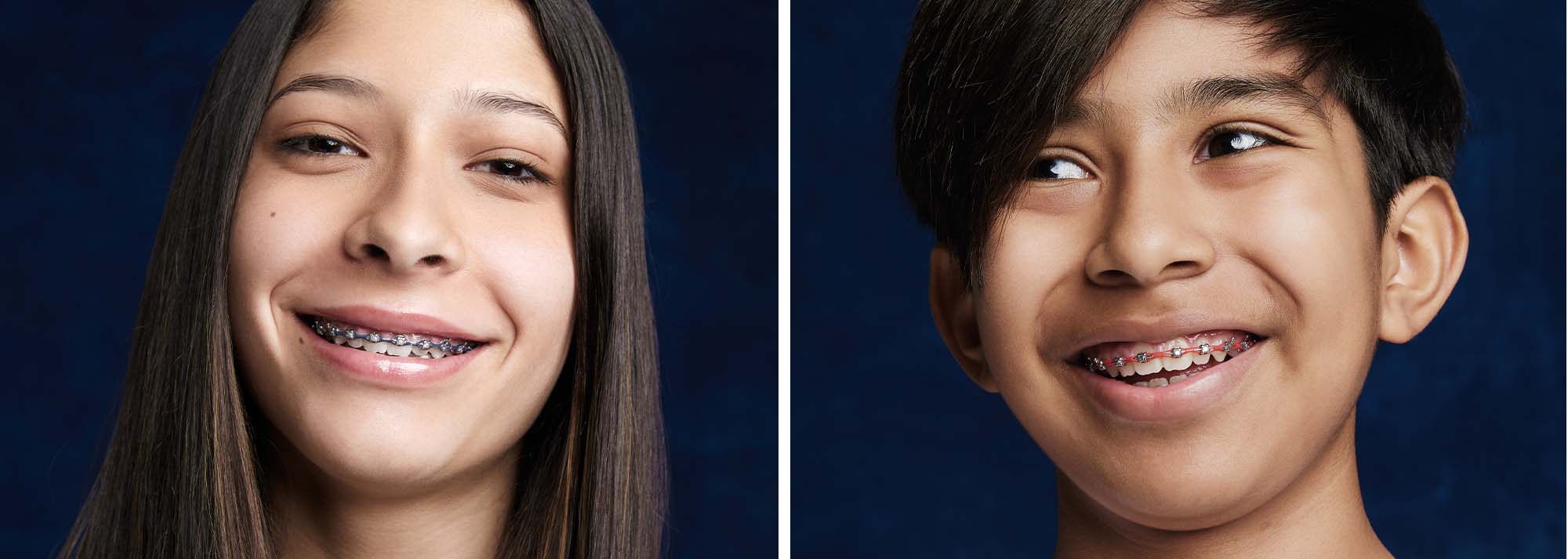 Metal braces orthodontic treatment offered by Smile Doctors